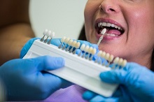 dentist examining female patient with teeth shades 1