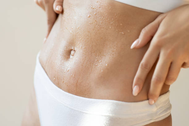Tummy Tuck in Riyadh