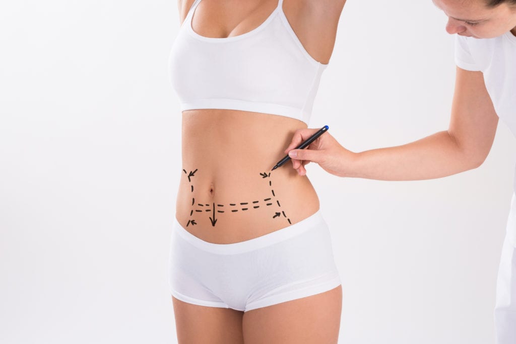 Tummy Tuck in Dubai