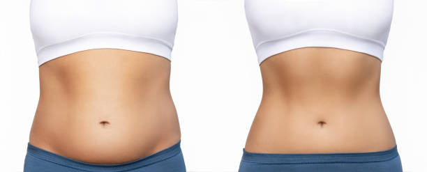 istockphoto 1415379461 612x612 1