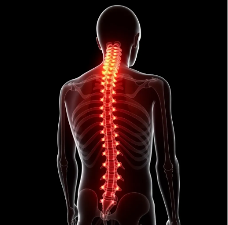 spinal stenosis