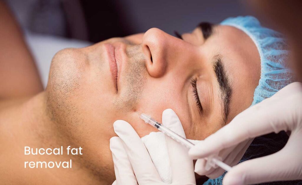 Buccal Fat Removal Journey: From Consultation On