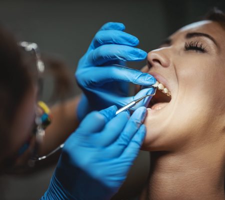 Dental glue for restorations