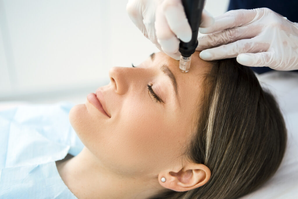 Vampire Facial in Dubai