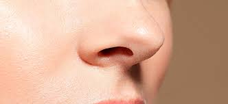 Nasal surgery