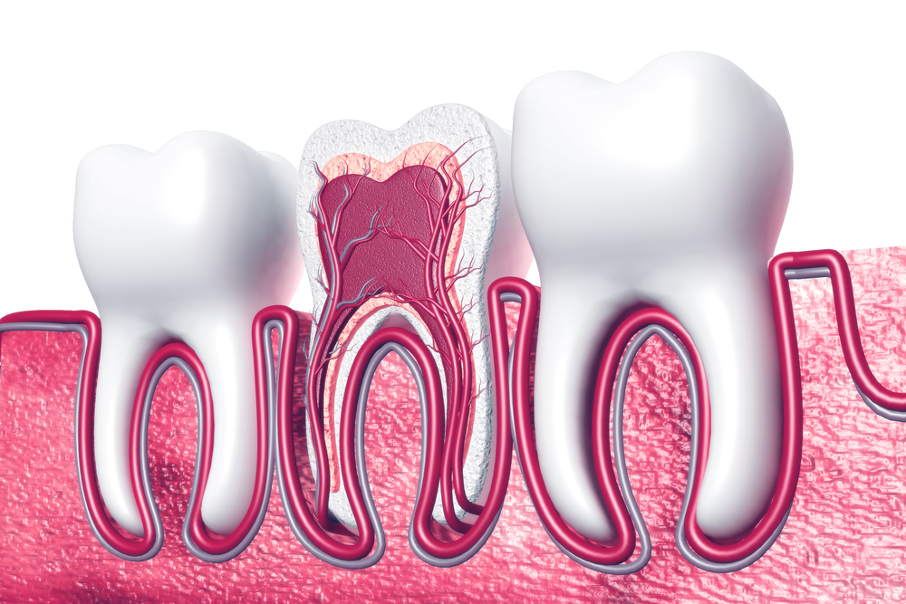 Root Canal Treatment in Islamabad
