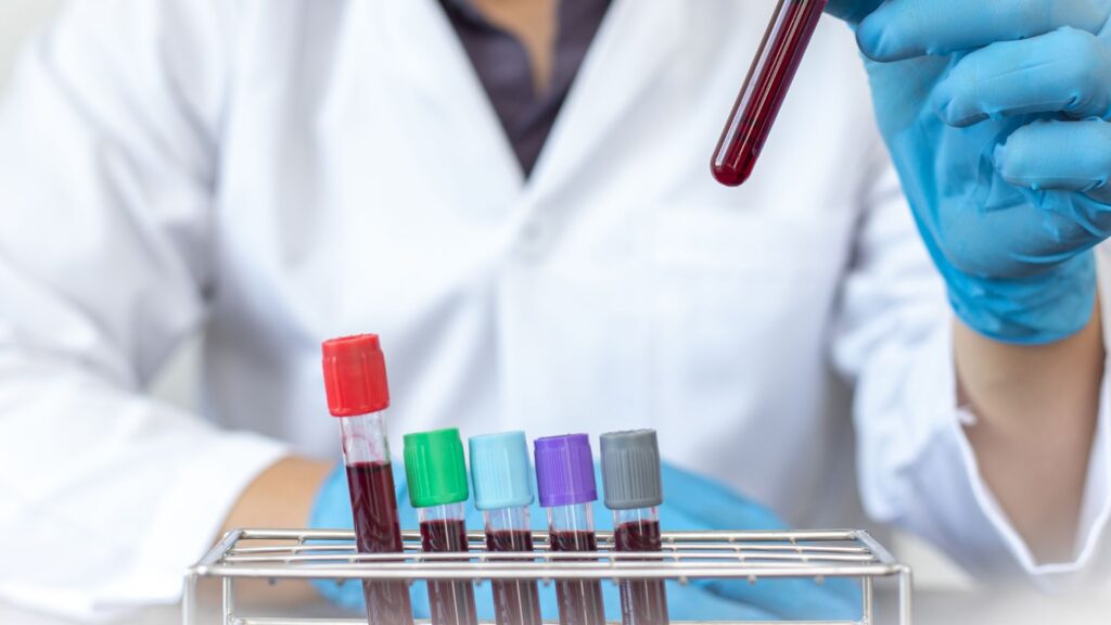 Saudi Arabia In-Vitro Diagnostics Market