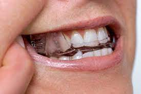 Tools to protect your teeth