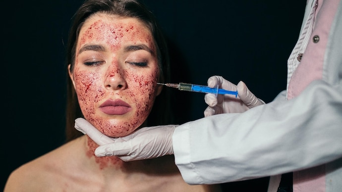 portrait of a young woman having an injection during her facial treatment 030438266