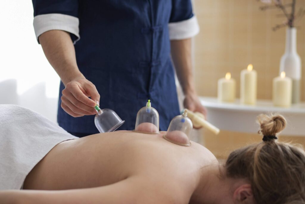 Hijama in Dubai