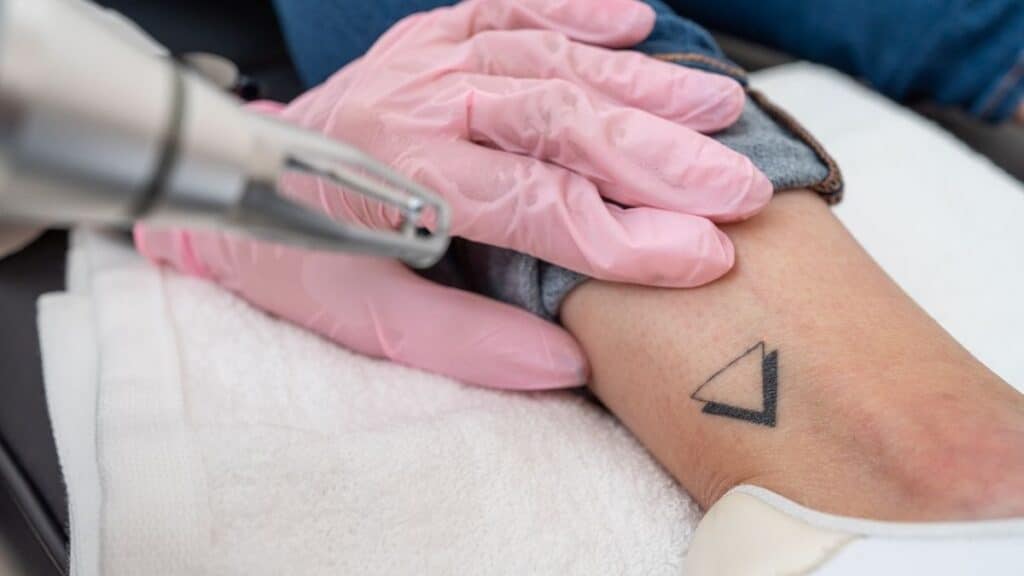 Does PicoSure Work on All Ink Colors
