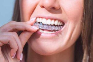 invisalign Dumfries
