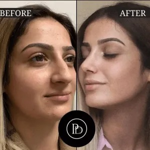 Best Plastic Surgeon in Dubai for a Safe, Subtle Transfor