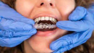  invisalign Kirkcaldy 