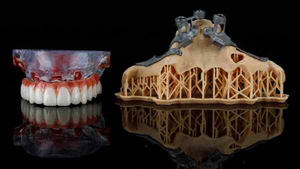 Smilo Dental Implants